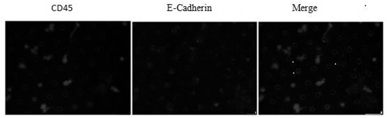 Immunofluorescence kit for detecting E-Cadherin expression of peripheral blood circulating tumor cells of patient with hepatocellular carcinoma and method