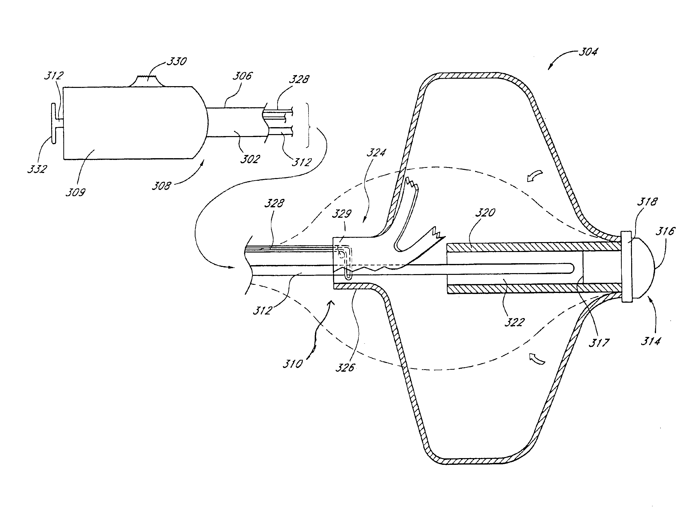 Method of implanting a device in the left atrial appendage
