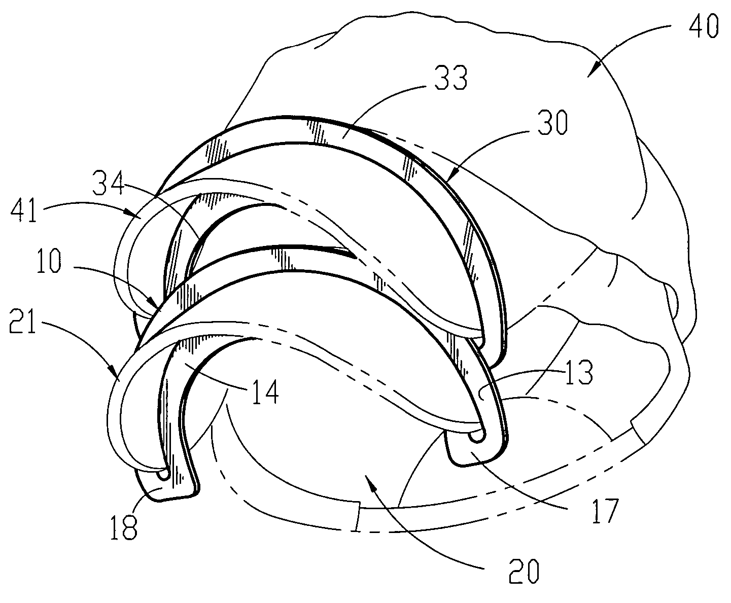 Athletic headwear shaping device and method