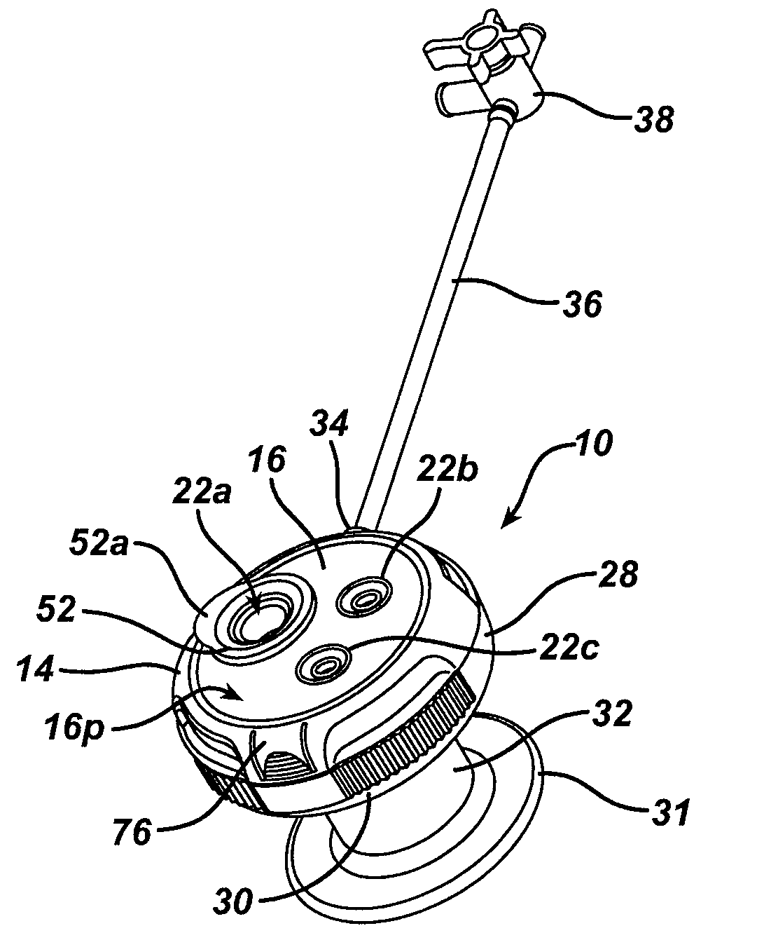 Methods and devices for providing access into a body cavity