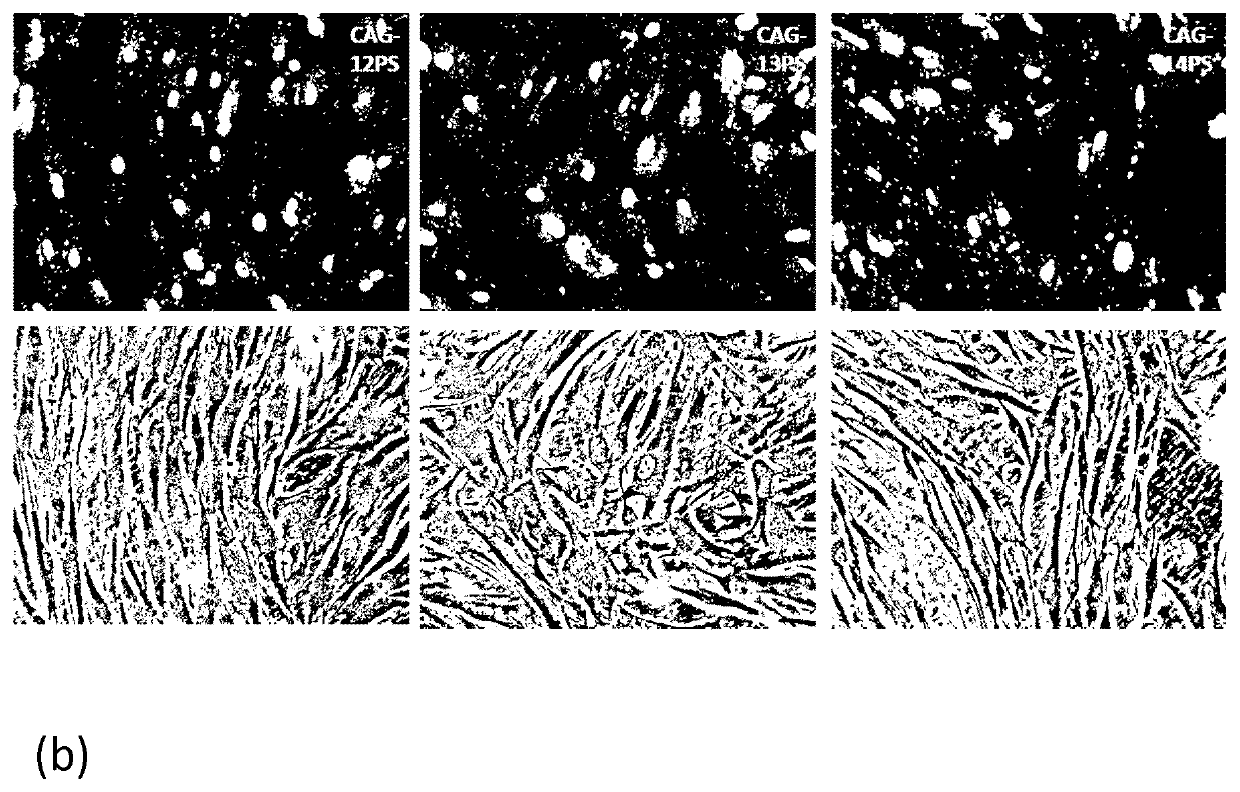 Therapeutic method for huntington's disease