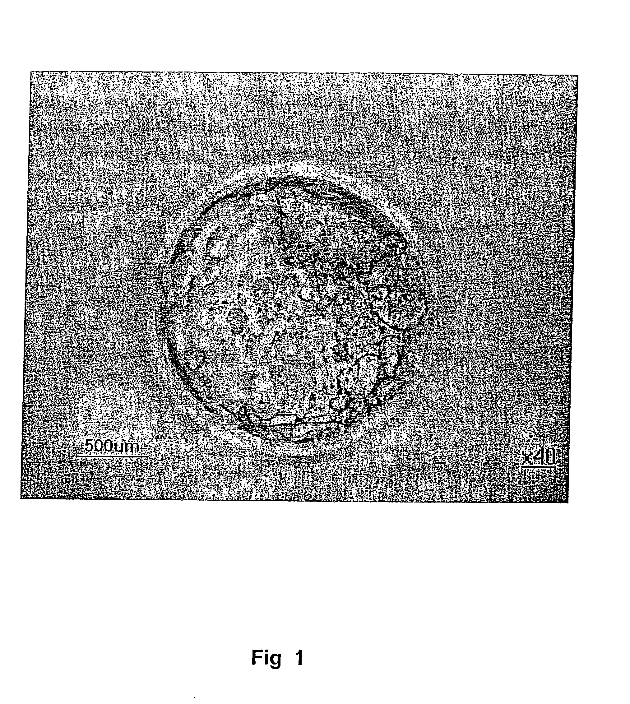 Method for the establishment of a pluripotent human blastocyst - derived stem cell line
