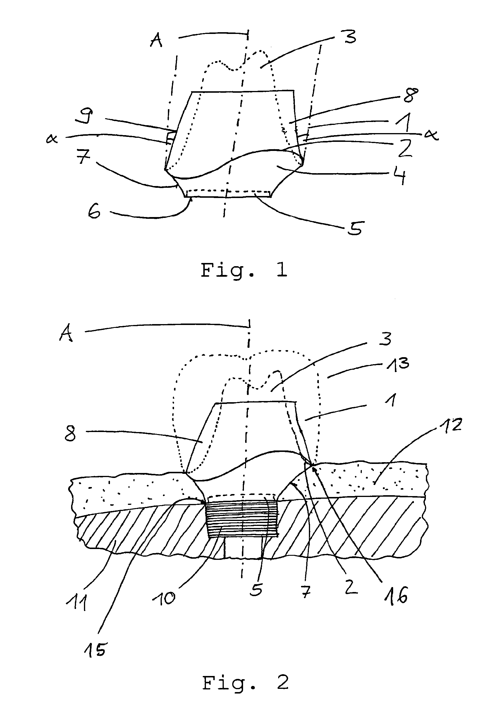 Gingiva former and method for producing a design of a gingiva former