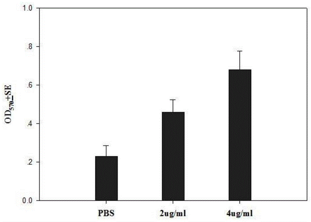 Immunoregulatory polypeptide as well as preparation method and application thereof