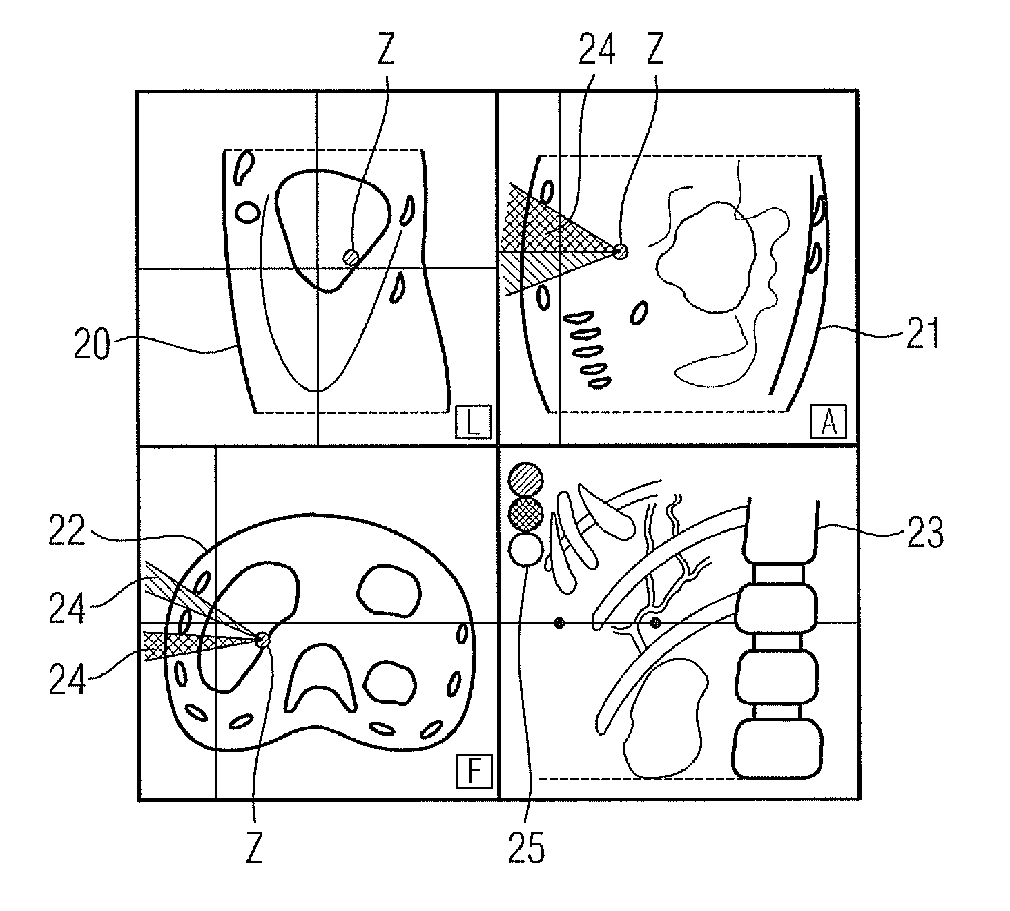 Method for Supporting Puncture Planning in a Puncture of an Examination Object