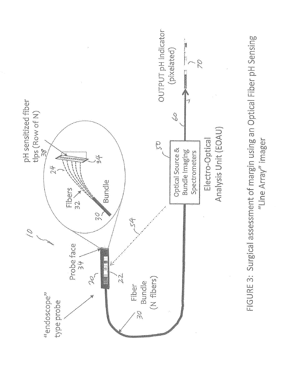 Apparatus and method for assessment of cancer margin