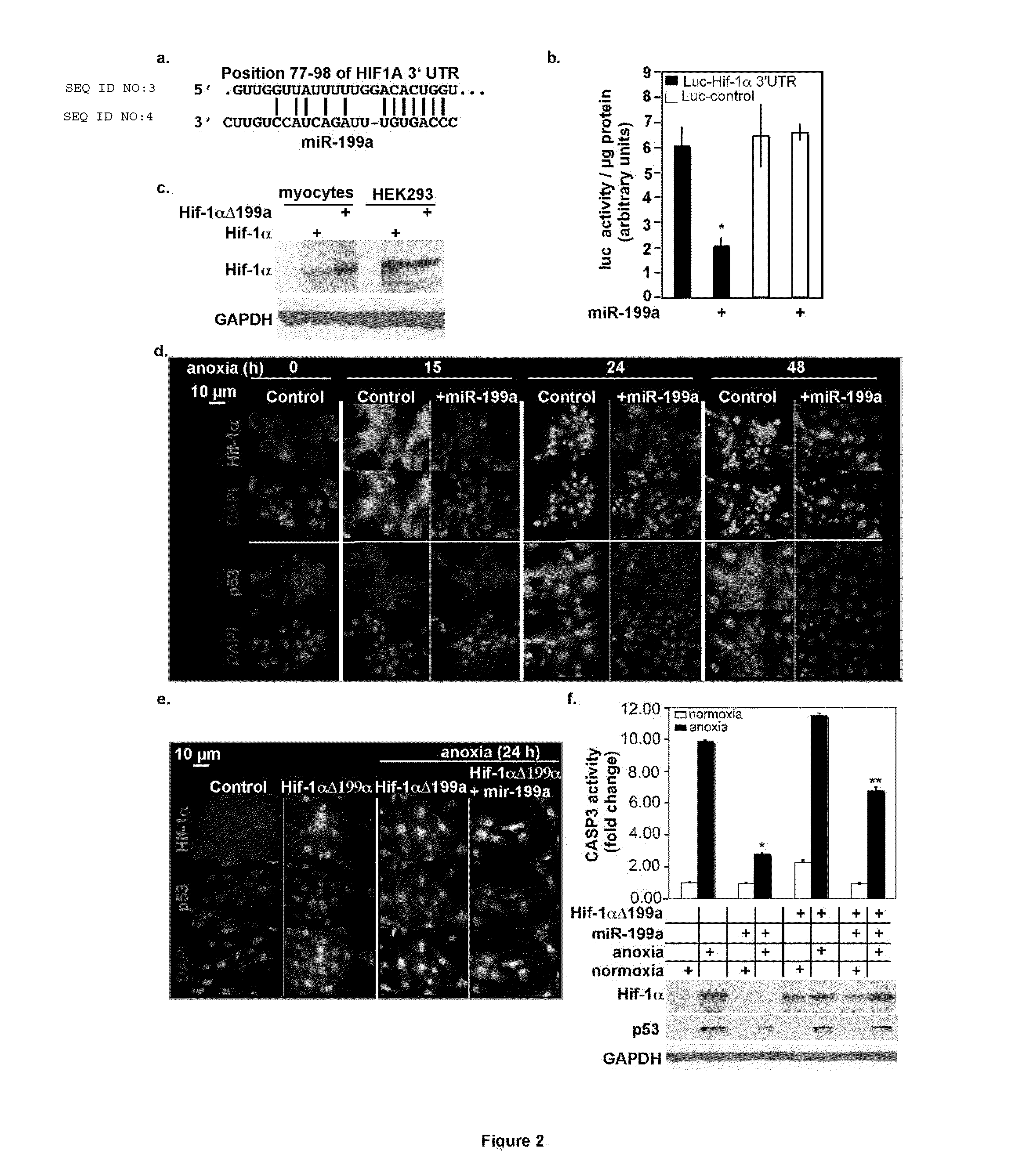 Anti-sense microrna expression vectors