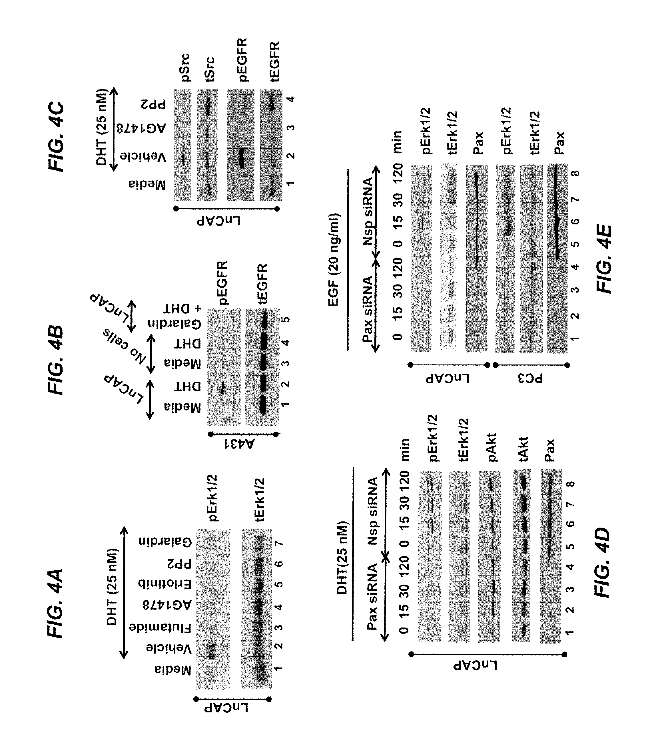 Paxillin as a therapeutic or diagnostic marker for cancer