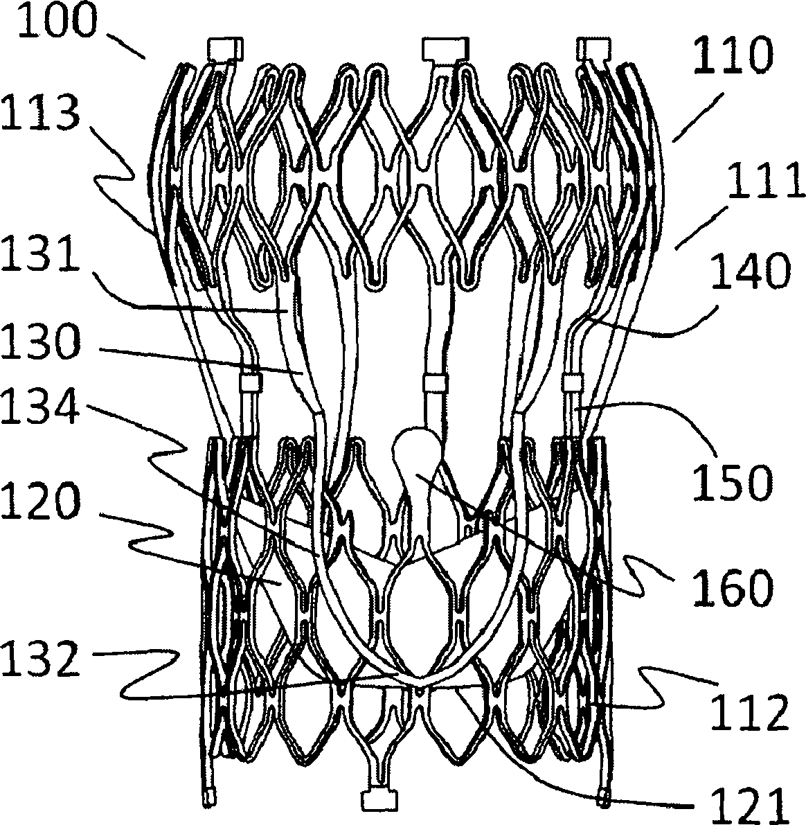 Artificial valve prosthesis with valve leaflet clamping device