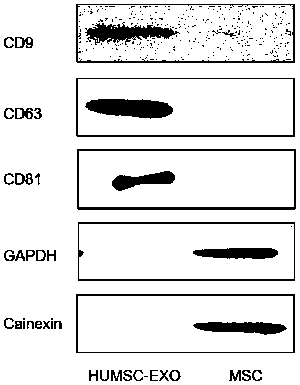 Application of stem cell exosomes to preparation of product capable of promoting wound healing