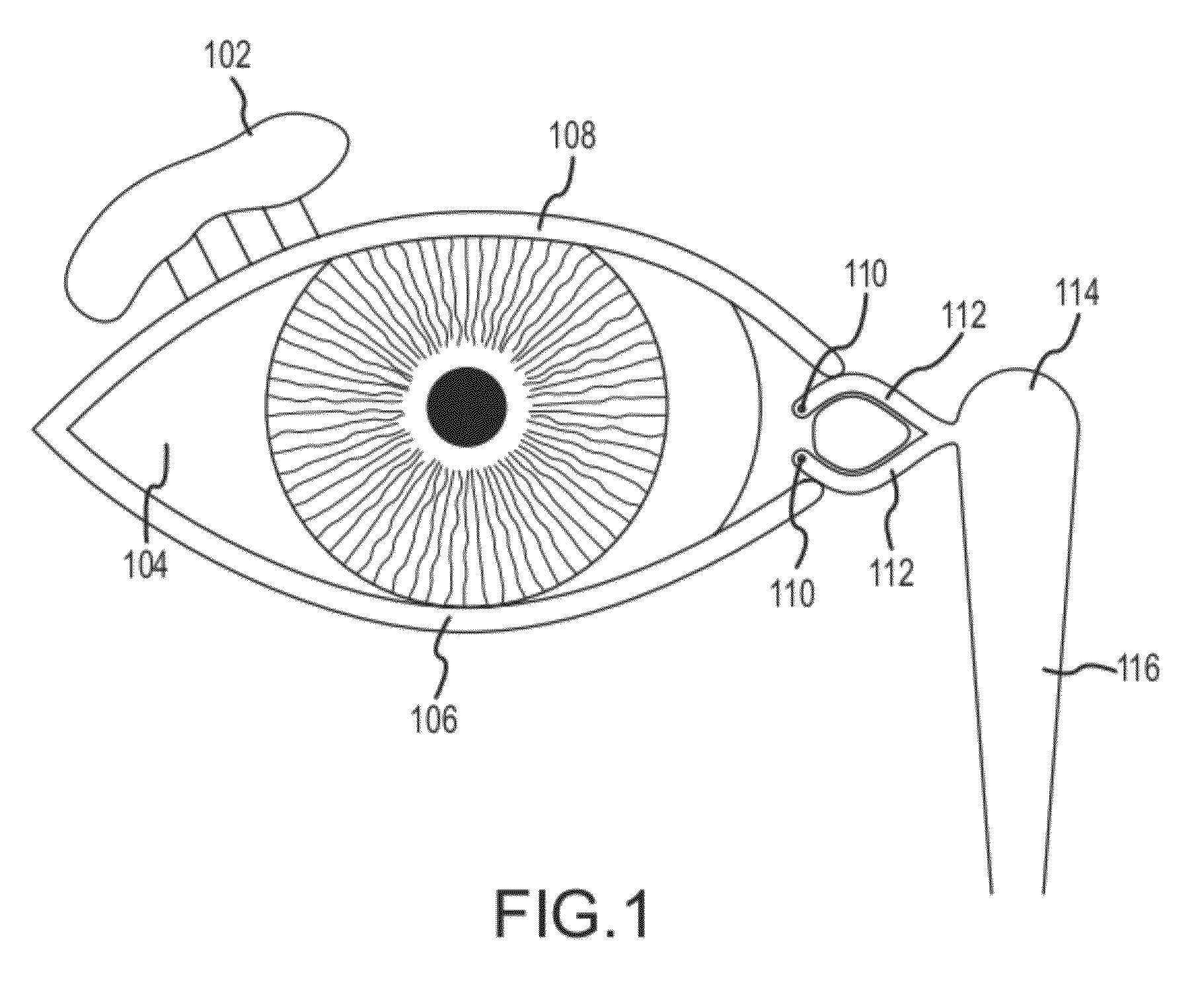 Implant device, tool, and methods relating to treatment of paranasal sinuses