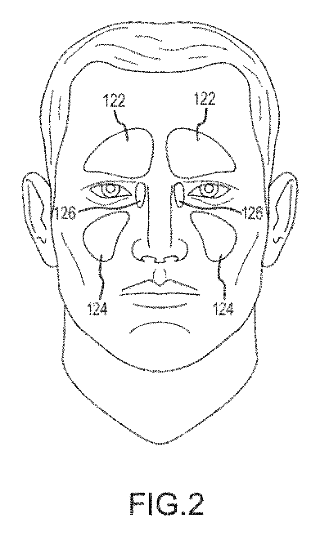 Implant device, tool, and methods relating to treatment of paranasal sinuses