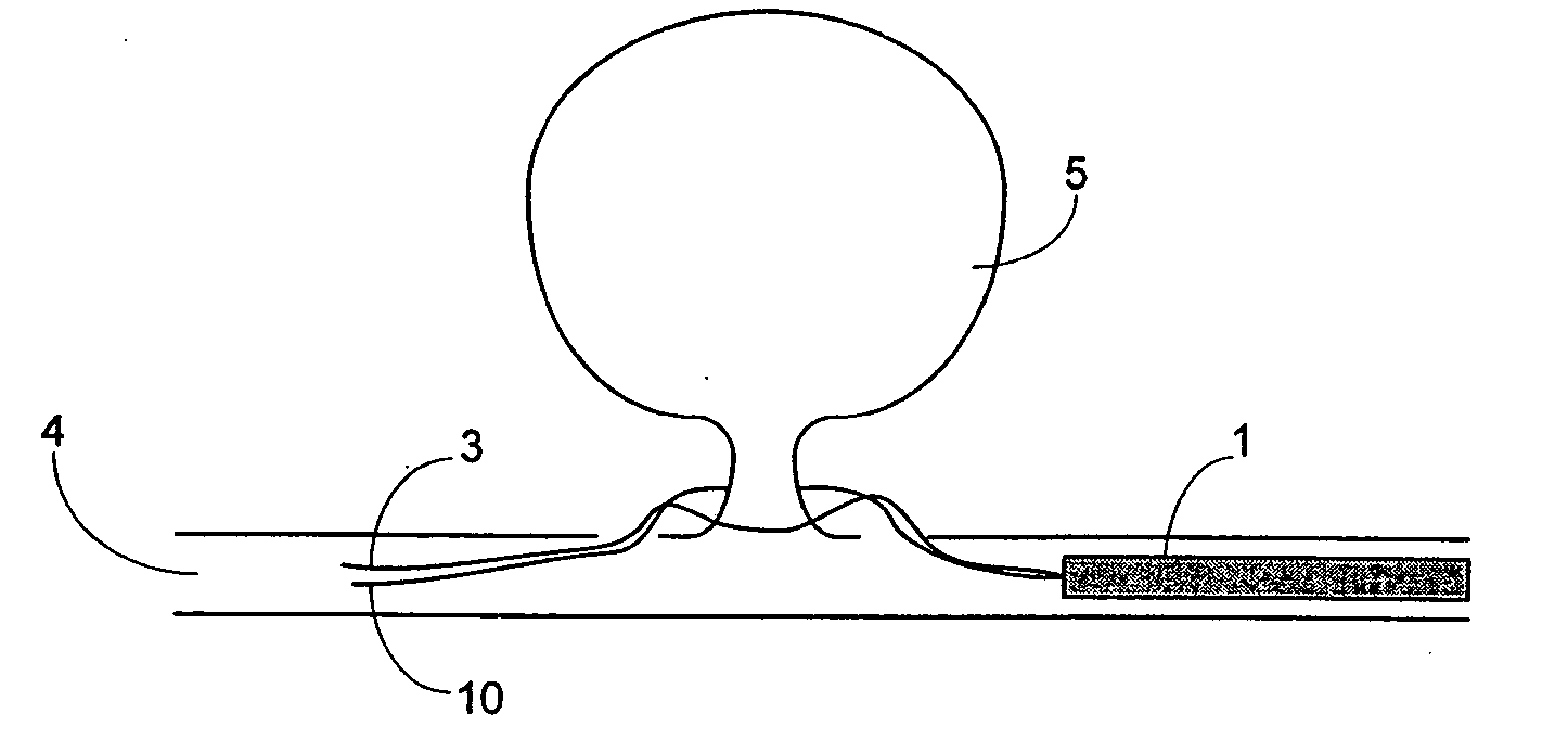 Device and methods for non-surgical clipping of aneurysms