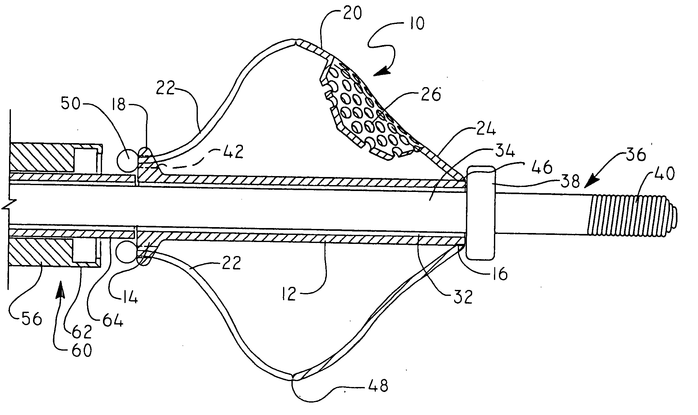 Cartridge embolic protection filter and methods of use