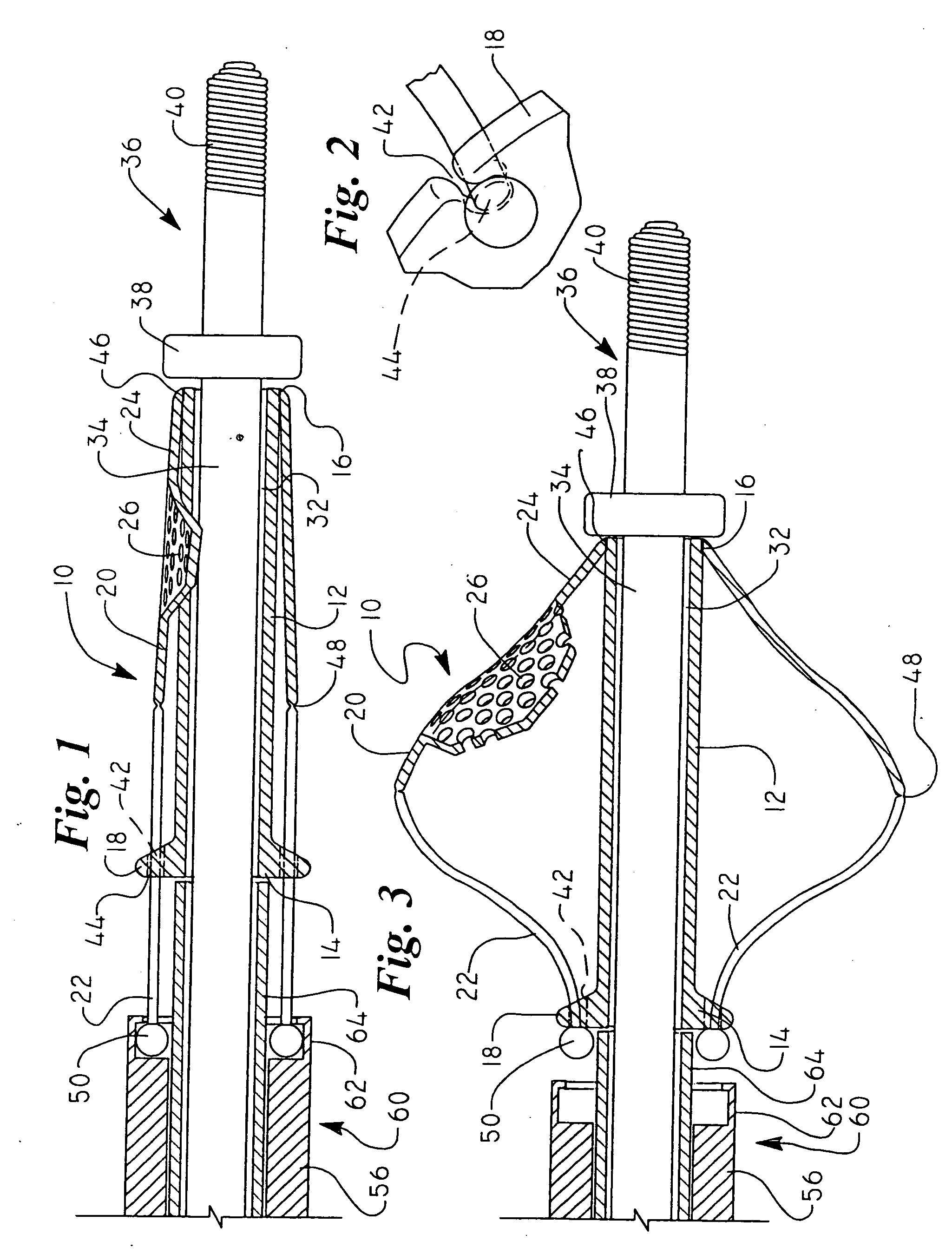 Cartridge embolic protection filter and methods of use