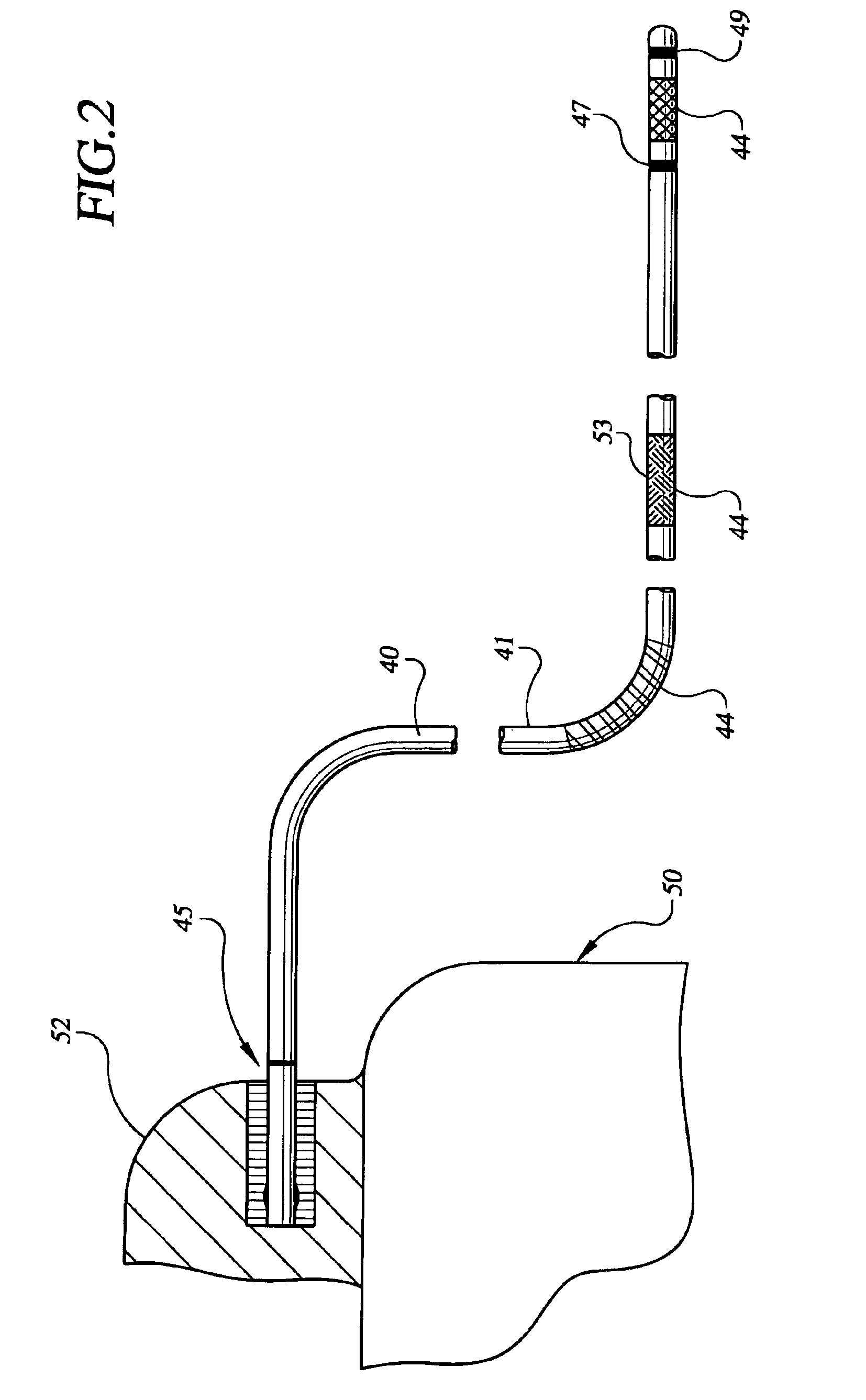 Apparatus and method for stabilizing an implantable lead
