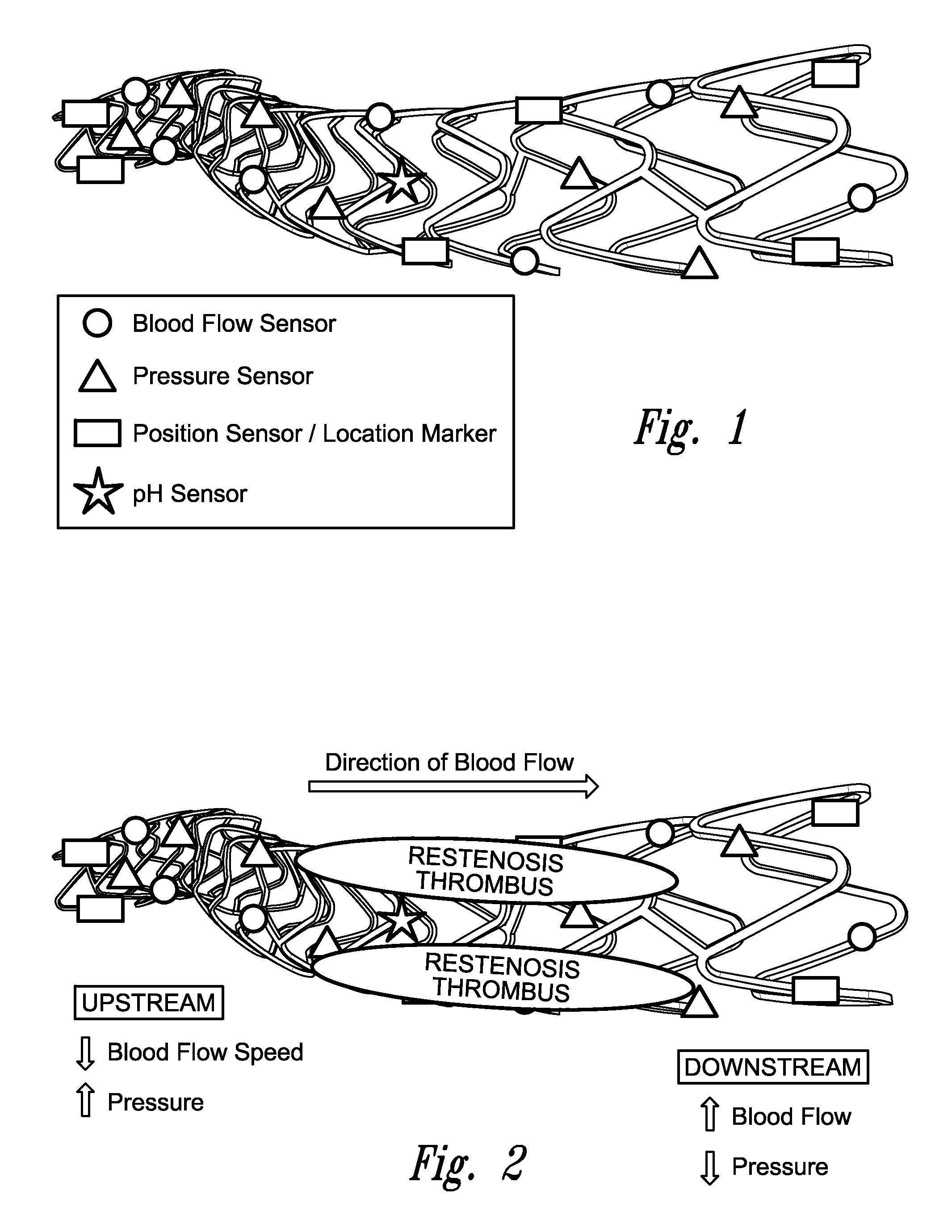 Stent monitoring assembly and method of use thereof