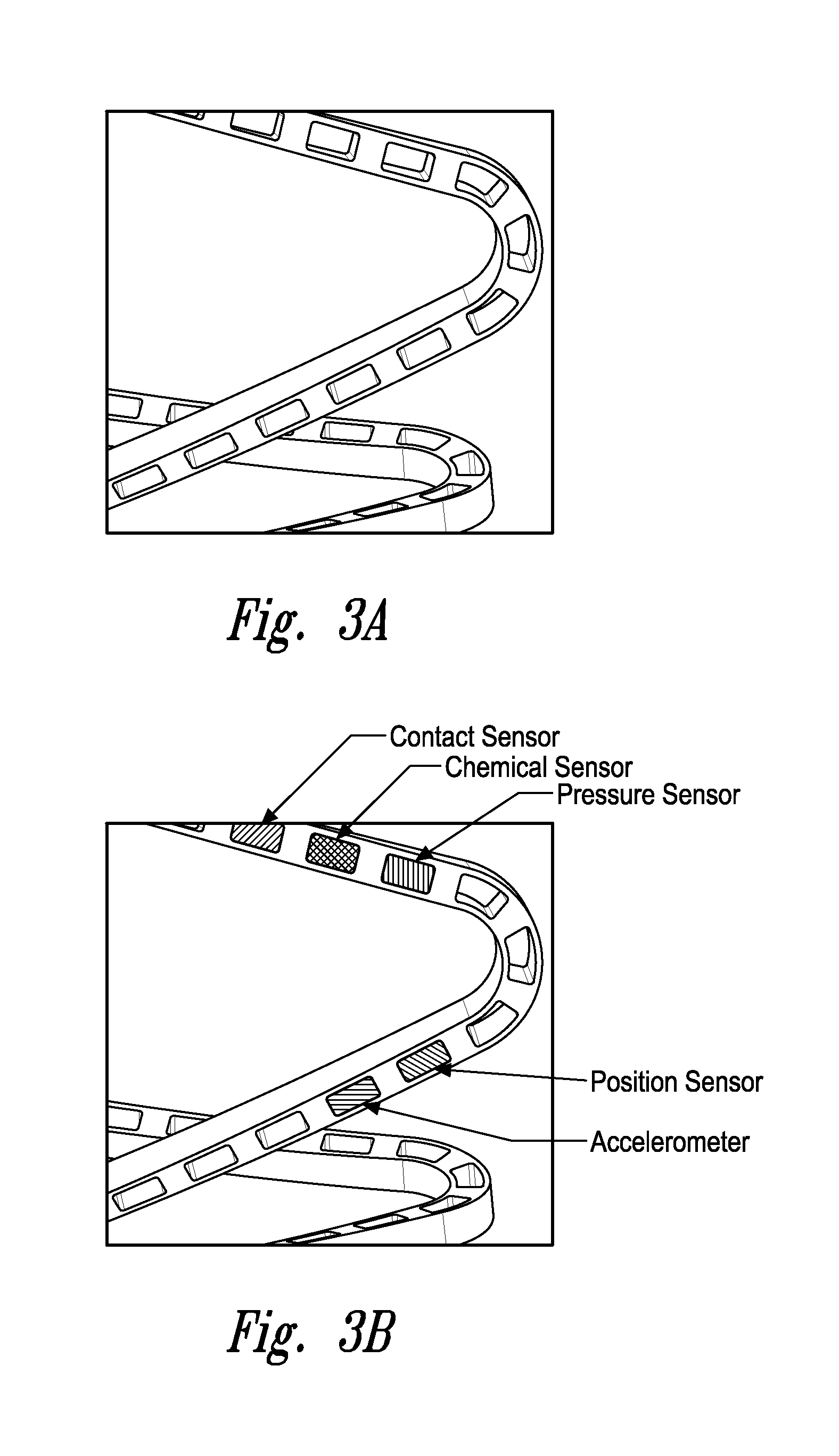 Stent monitoring assembly and method of use thereof