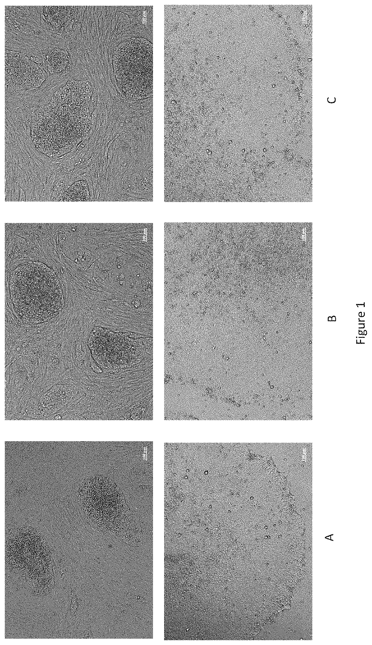 Method for preparing induced pluripotent stem cells by reprogramming somatic cells