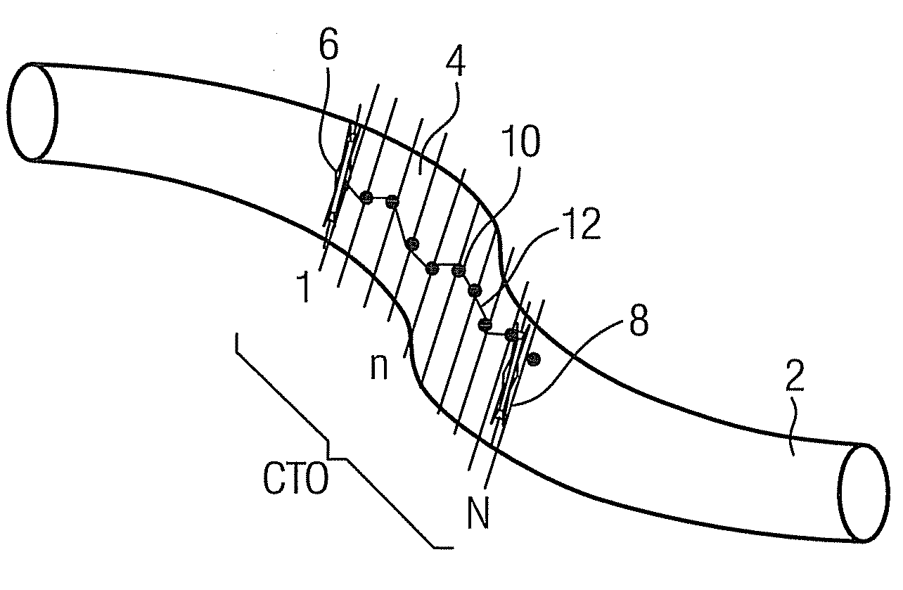 Method and device for navigating a catheter through a blockage region in a vessel