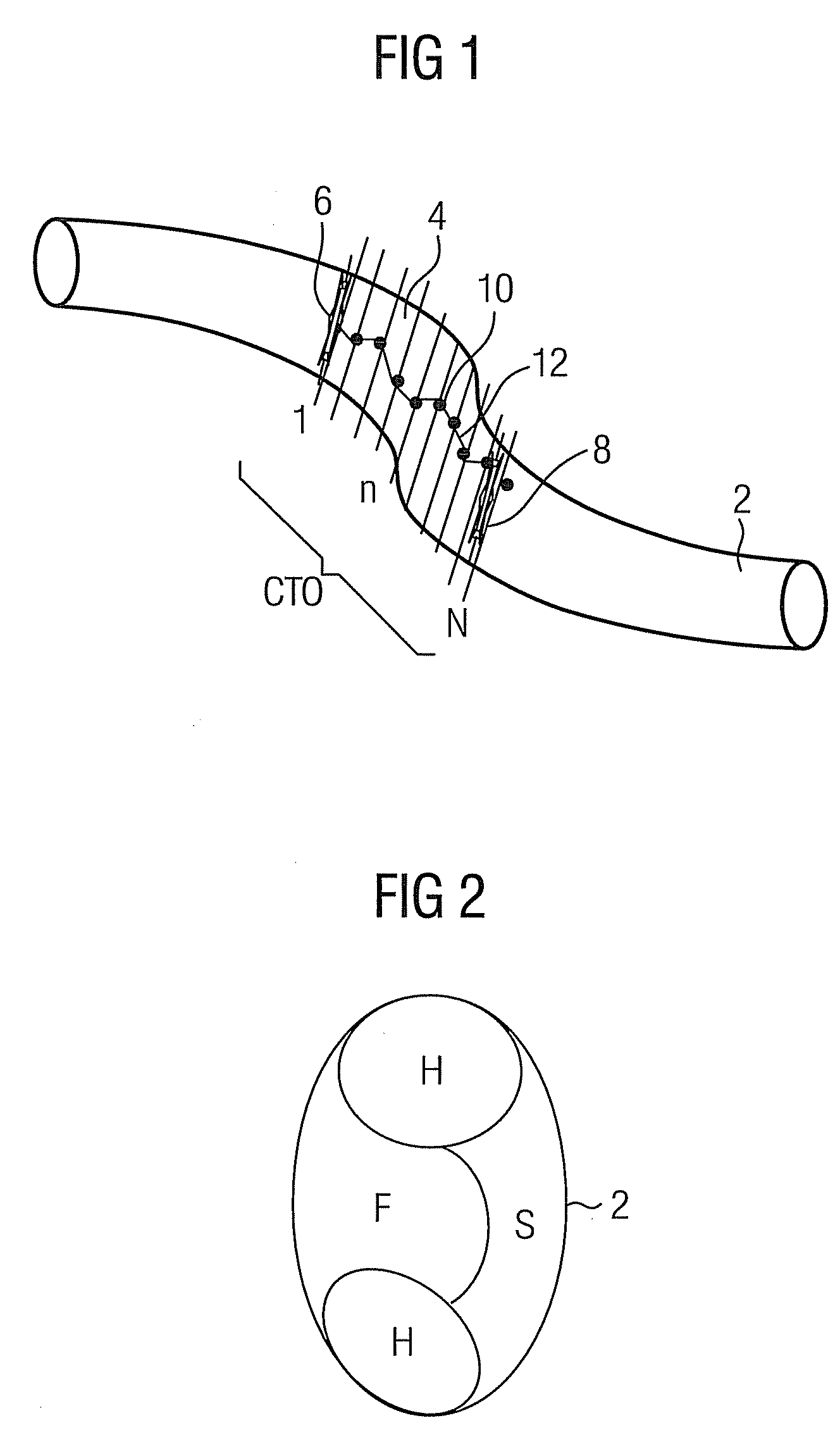 Method and device for navigating a catheter through a blockage region in a vessel