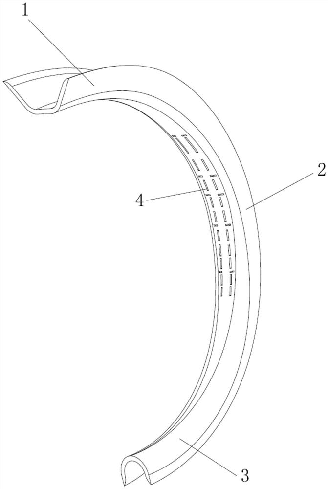 Auxiliary stent beneficial to fixation and scar reduction after cranioauricular angle forming operation and preparation method thereof