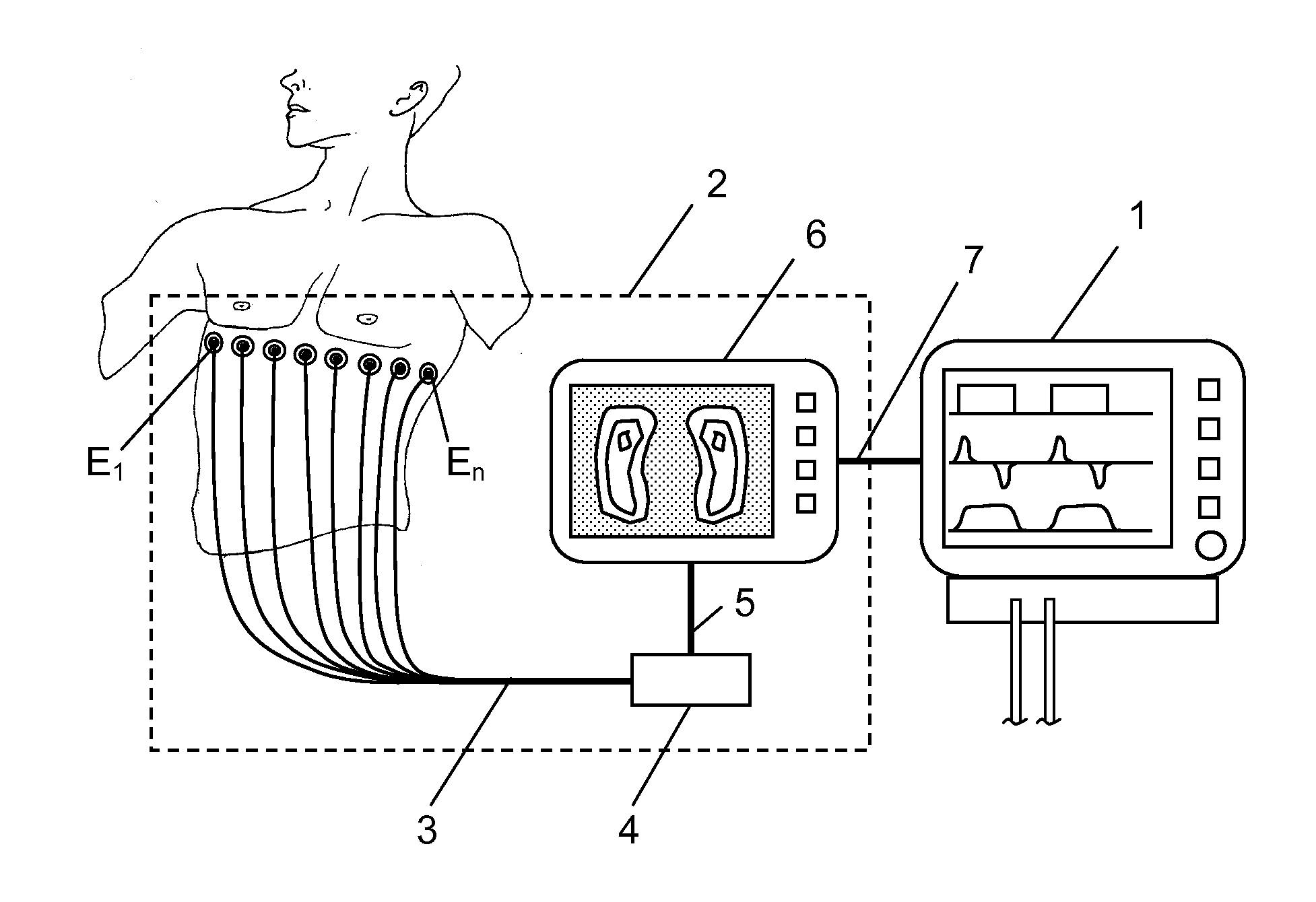 Apparatus and method to determine functional lung characteristics