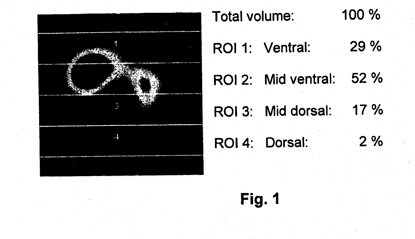 Apparatus and method to determine functional lung characteristics