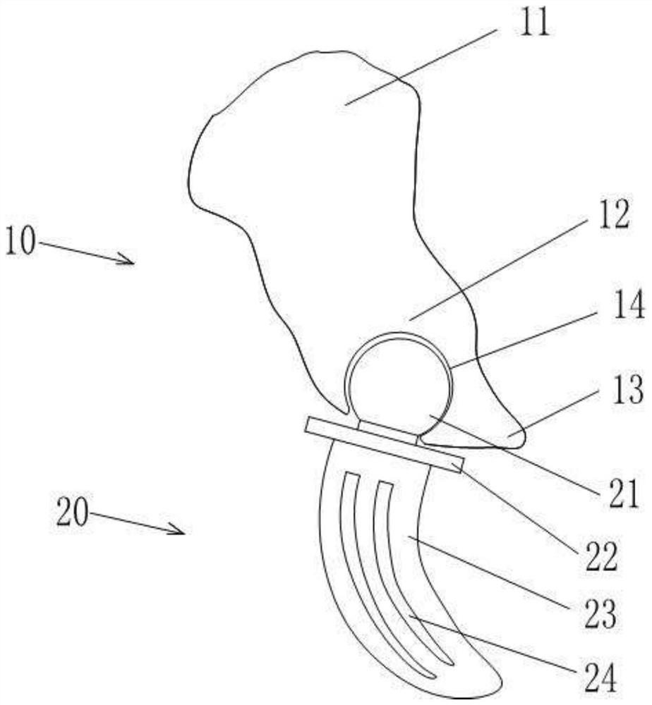 Adhesive ball socket joint type artificial navicular bone