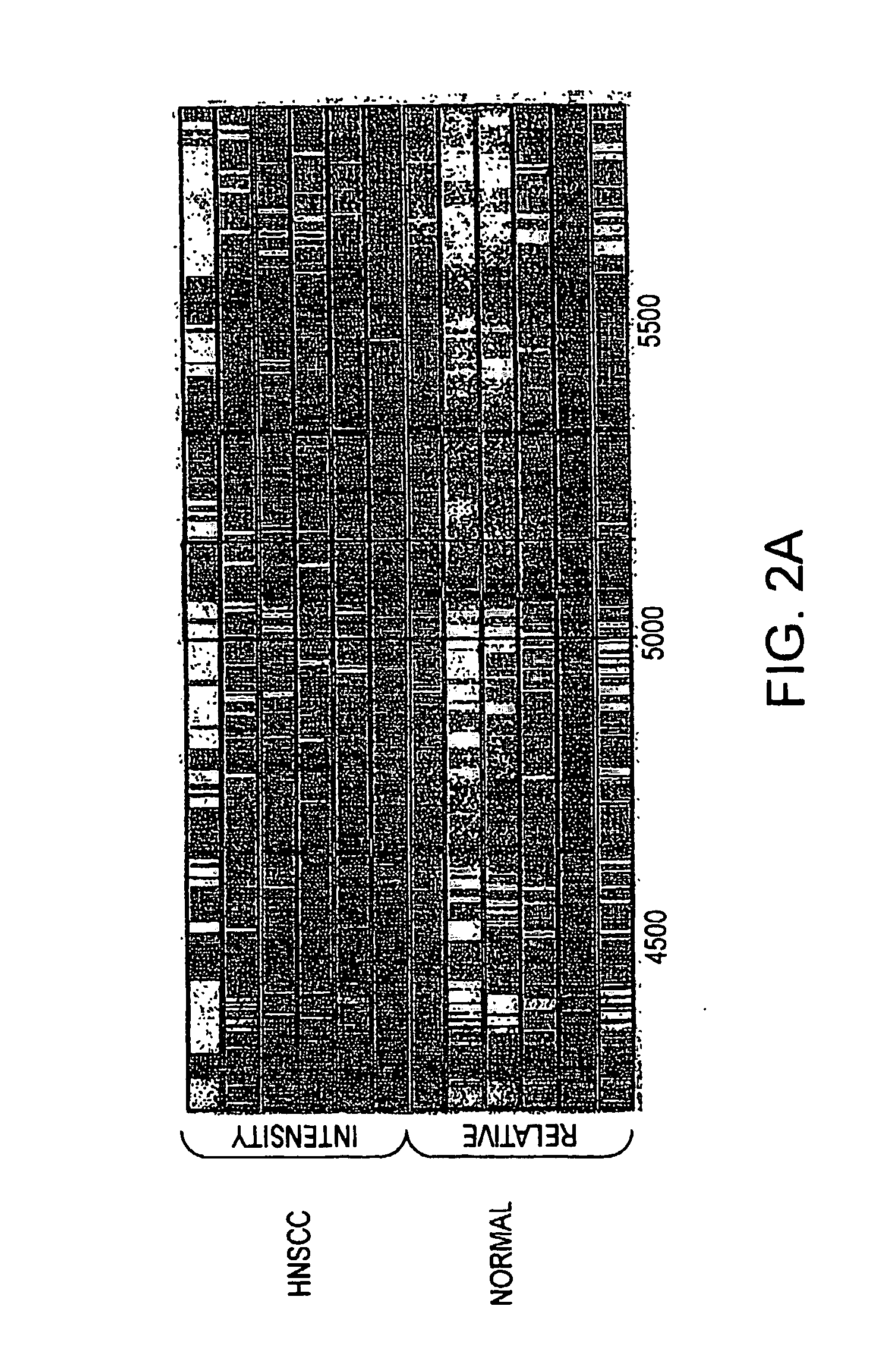 Method for diagnosing head and neck squamous cell carcinoma