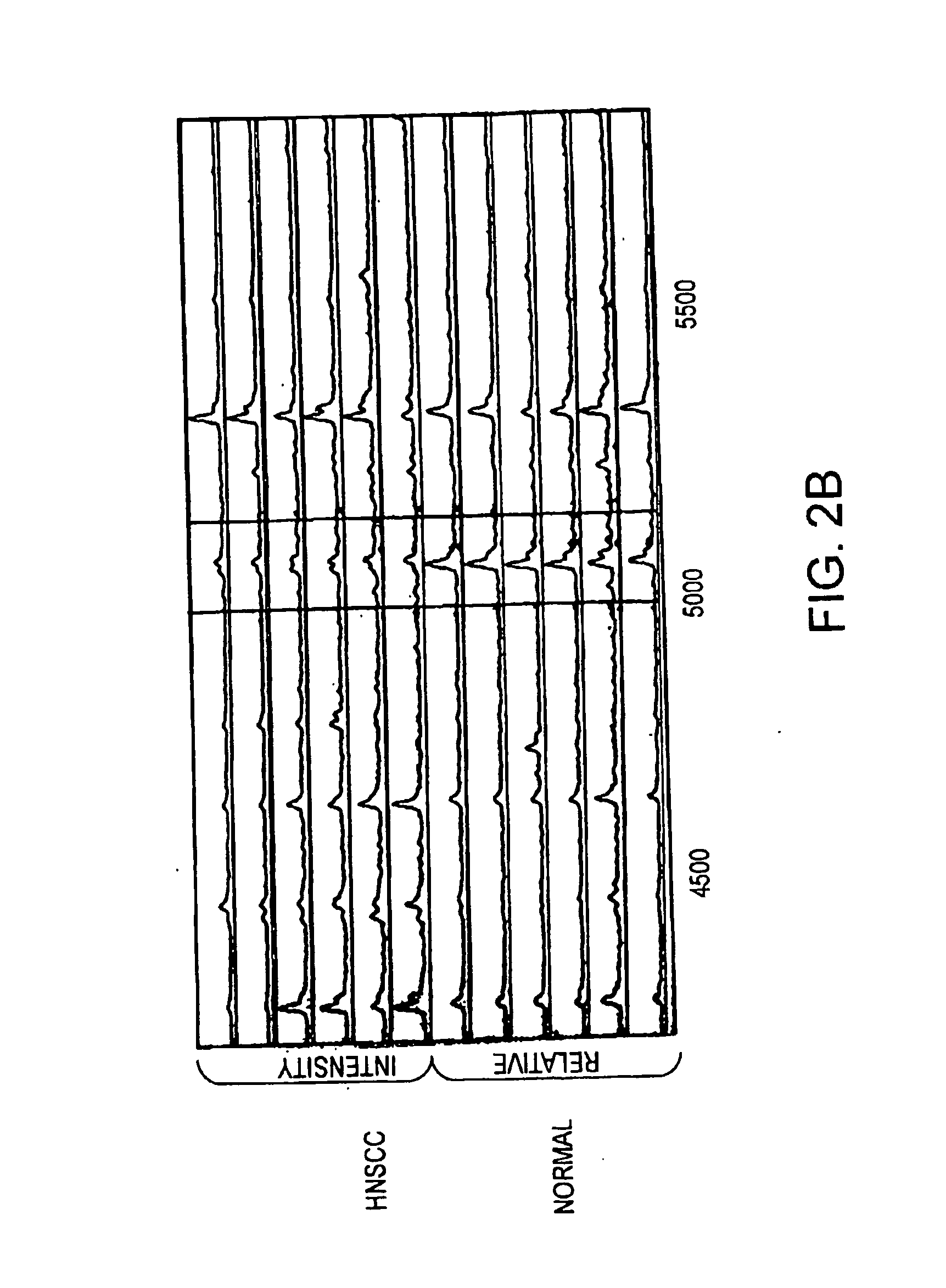 Method for diagnosing head and neck squamous cell carcinoma