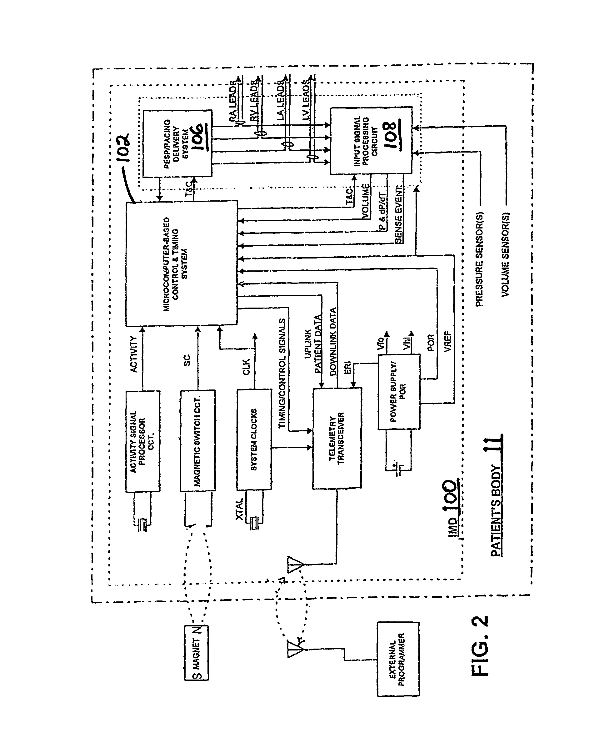 Method and system for controlling pulmonary capillary pressure