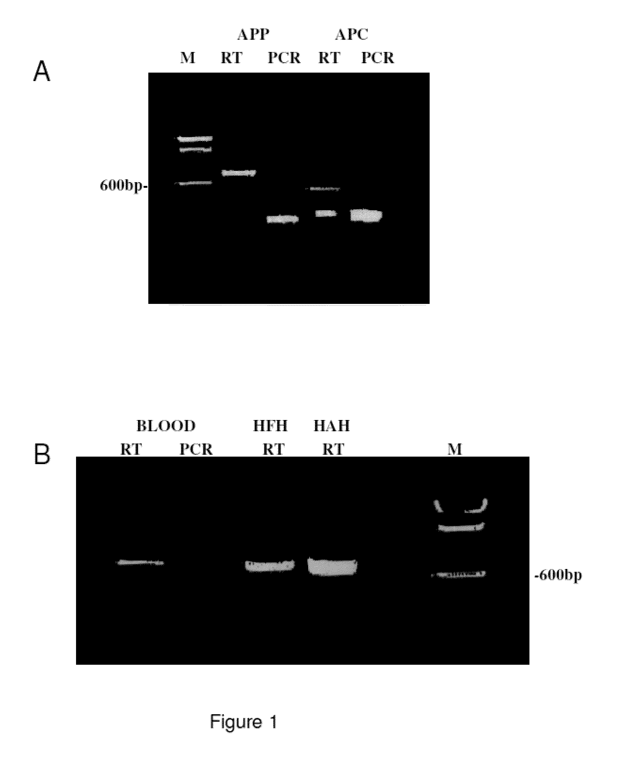 Method for the detection of schizophrenia related gene transcripts in blood