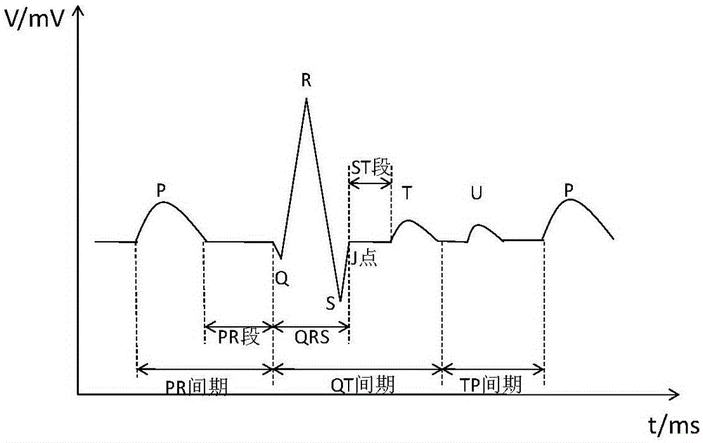 Method for recognizing ST segment of electrocardiosignal