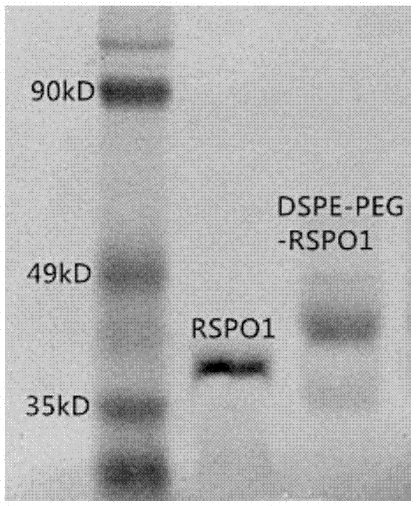 RSPO1-containing targeted drug delivery system, preparation and applications thereof