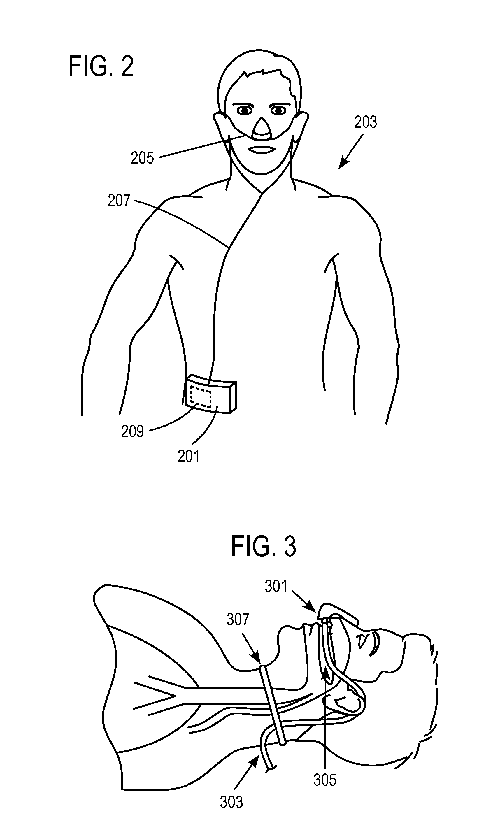 Methods, systems and devices for non-invasive open ventilation with gas delivery nozzles within an outer tube