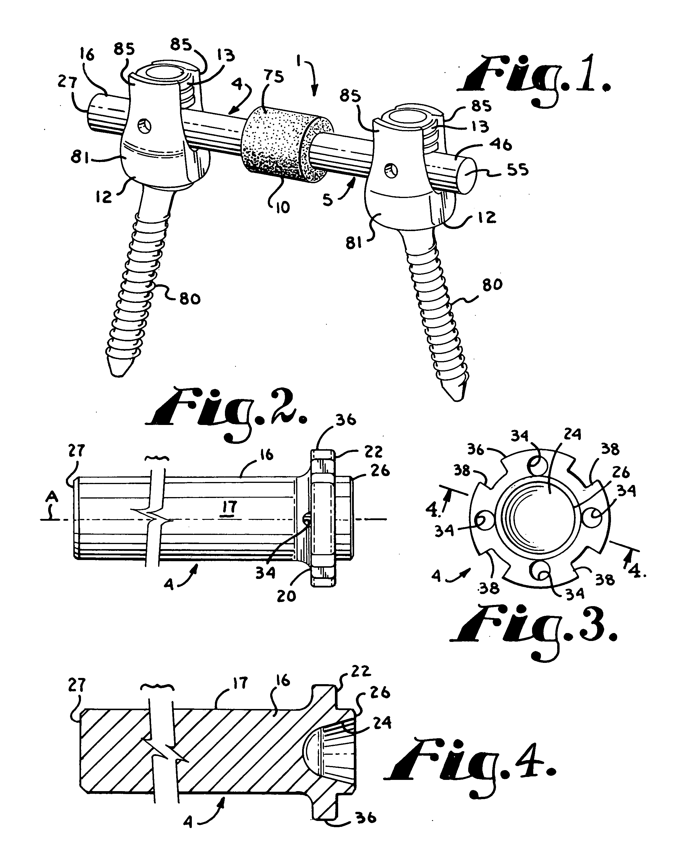 Dynamic stabilization assembly with frusto-conical connection