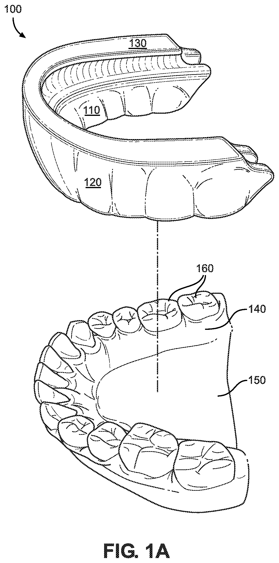 Single arch dental device and method of manufacture