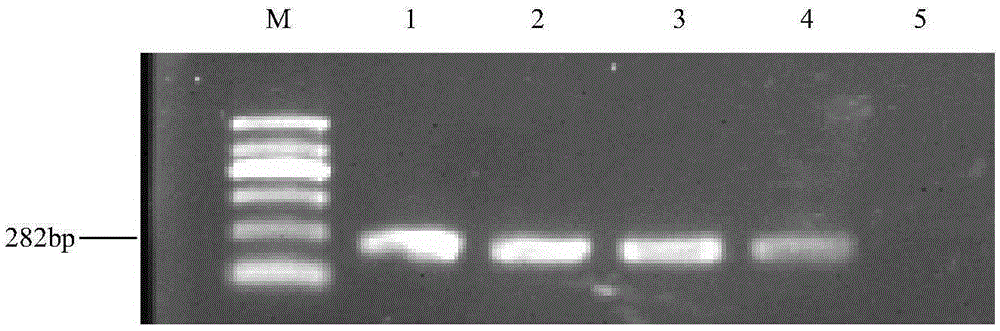 Fluorescent quantitative PCR detection kit for quickly detecting pythium aphanidermatum