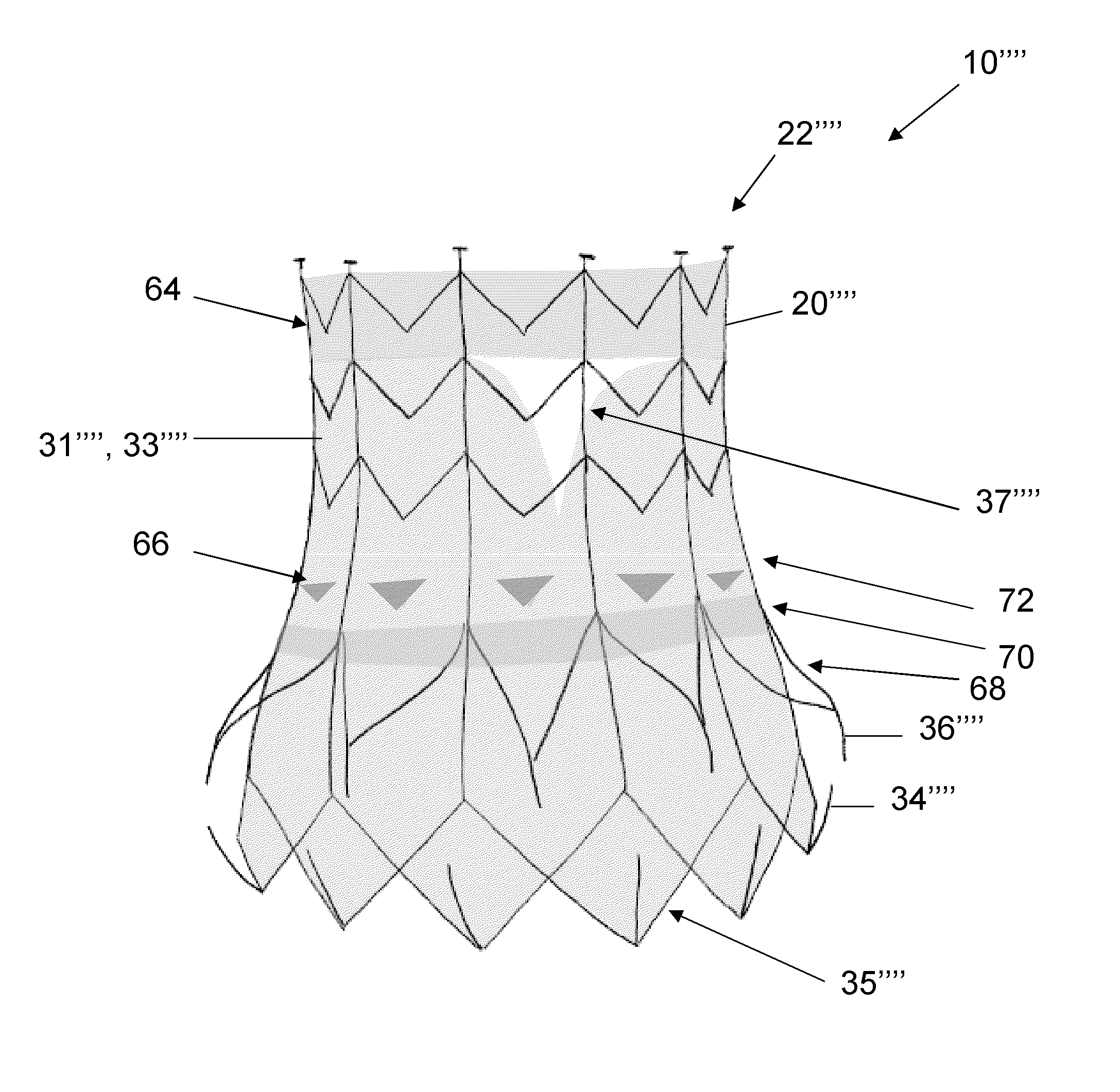 Replacement heart valve and method