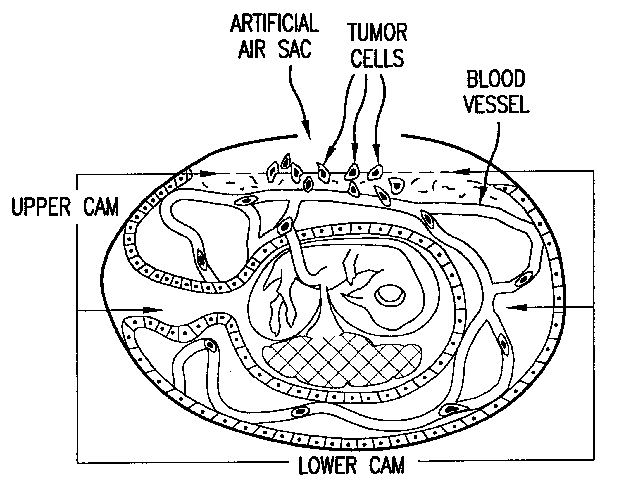 In vivo assay for intravasation