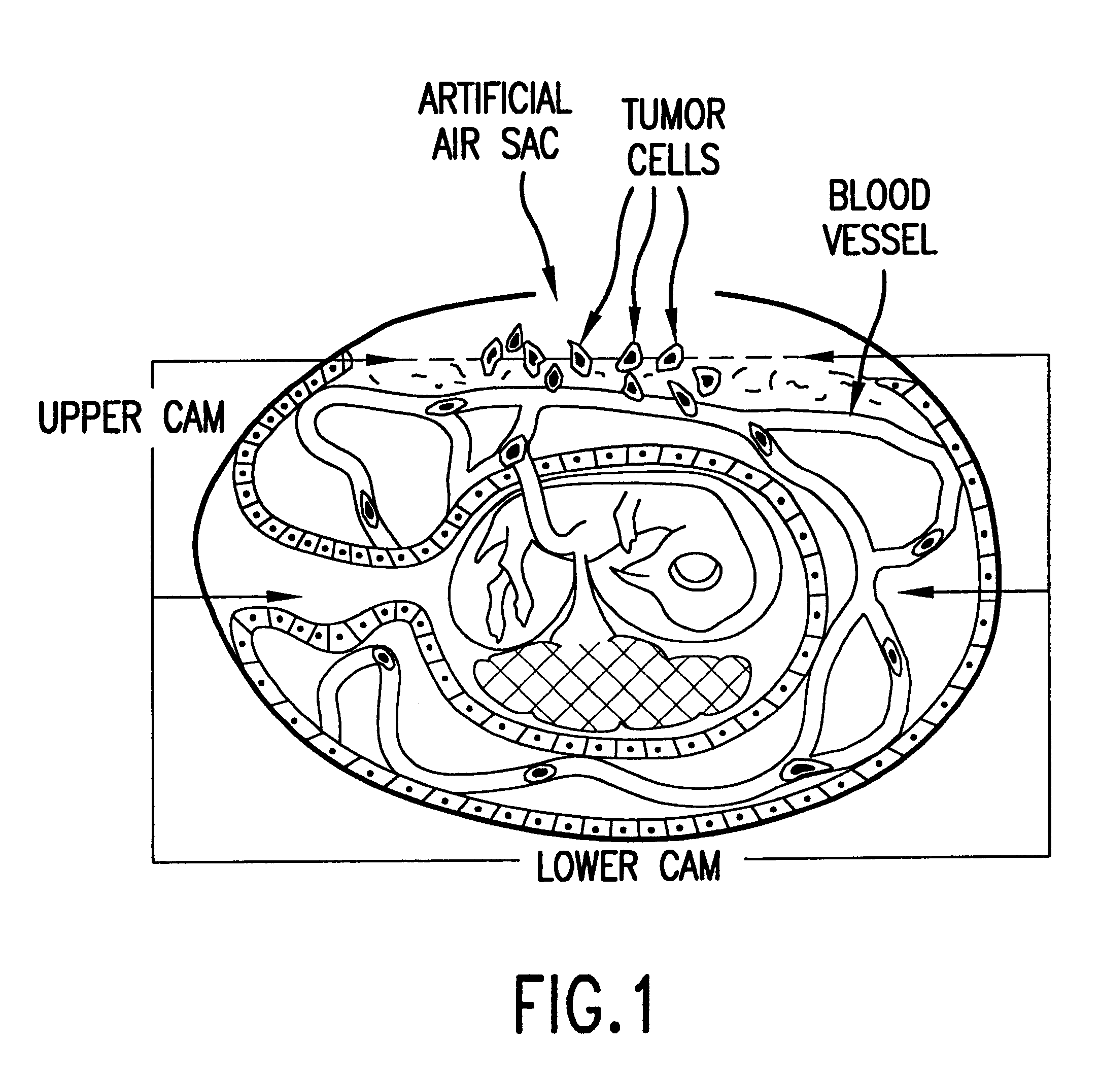 In vivo assay for intravasation