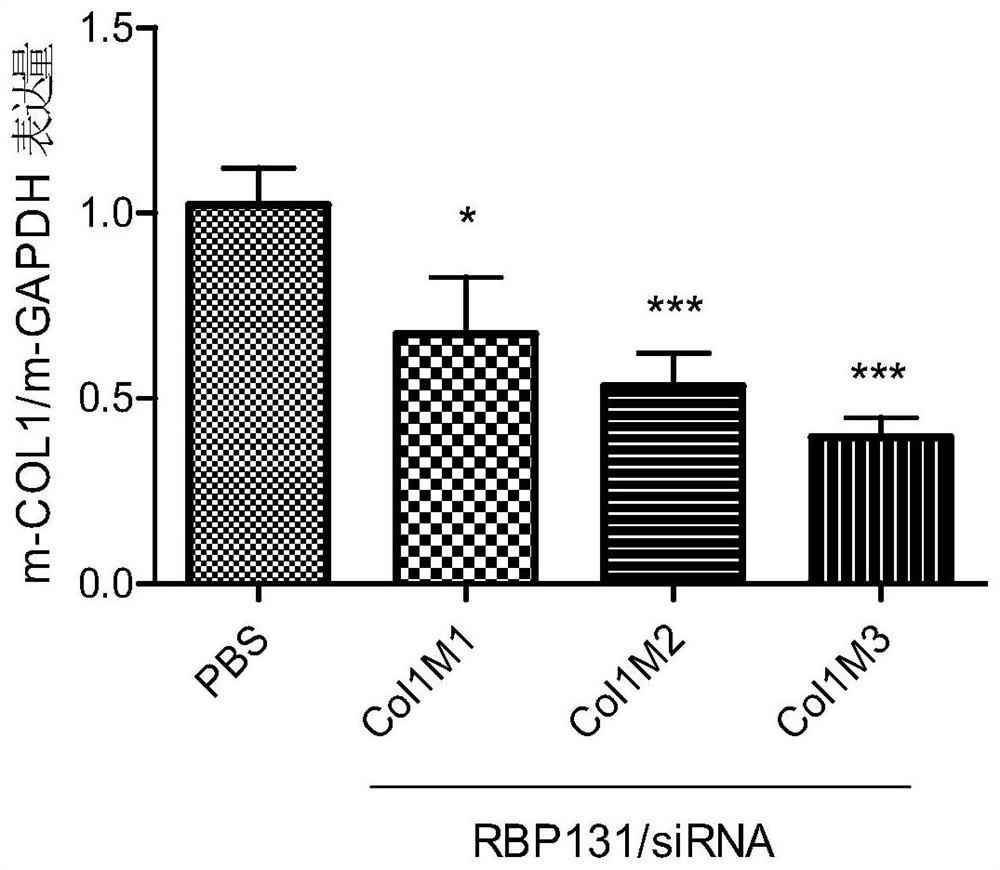 siRNA that suppresses col1a1 gene expression in humans and animals, compositions comprising it, and applications thereof