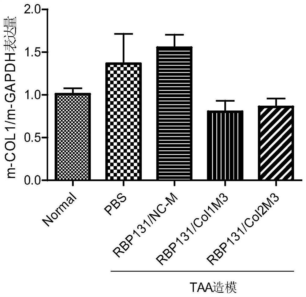 siRNA that suppresses col1a1 gene expression in humans and animals, compositions comprising it, and applications thereof