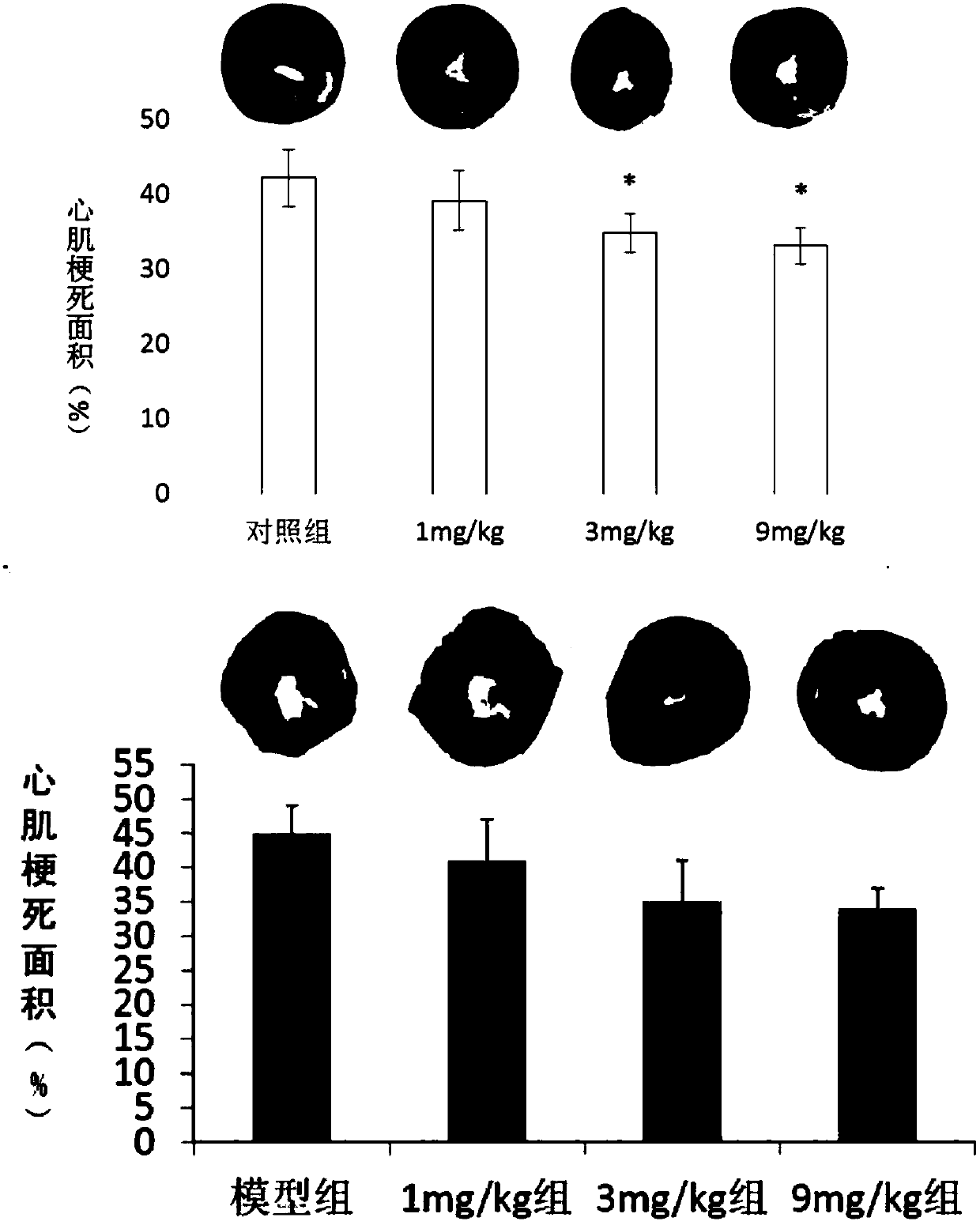 Application of p75ECD in preparation of drugs for treating myocardial infarction