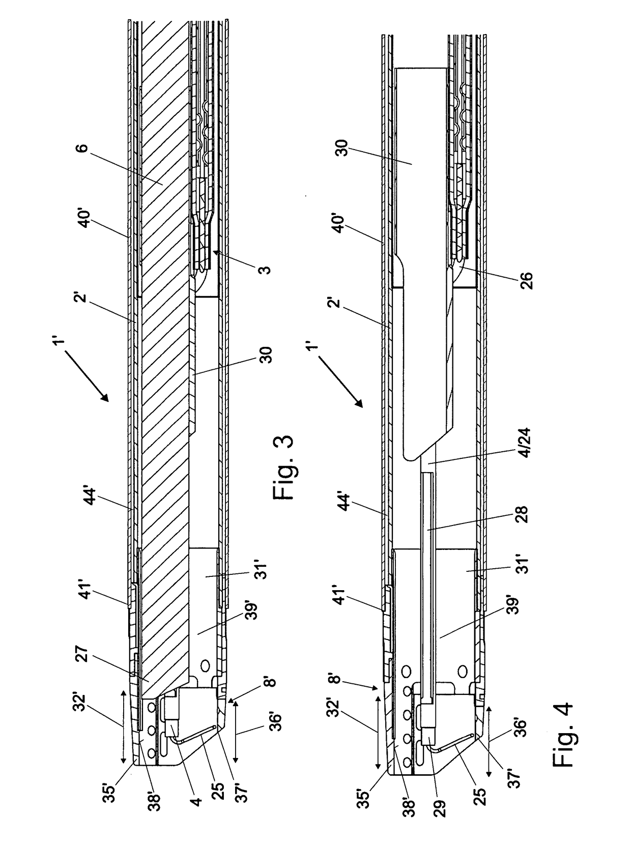 Bipolar resectoscope