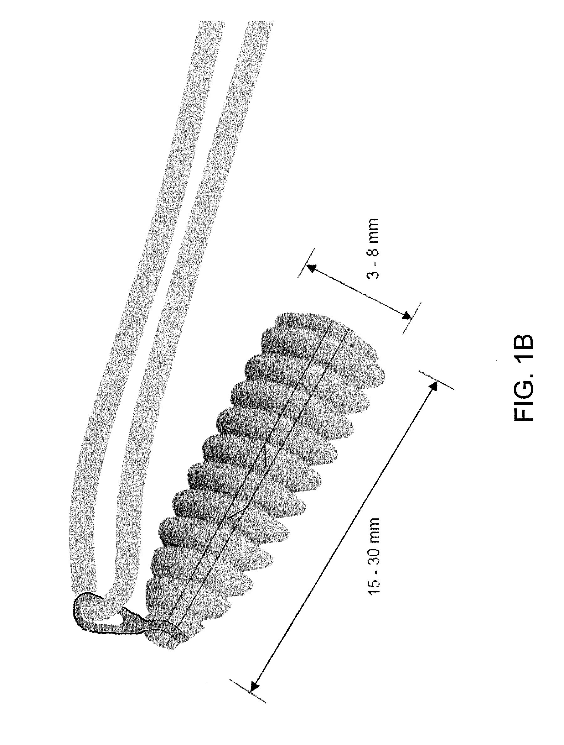 Implant and method for repair of the anterior cruciate ligament