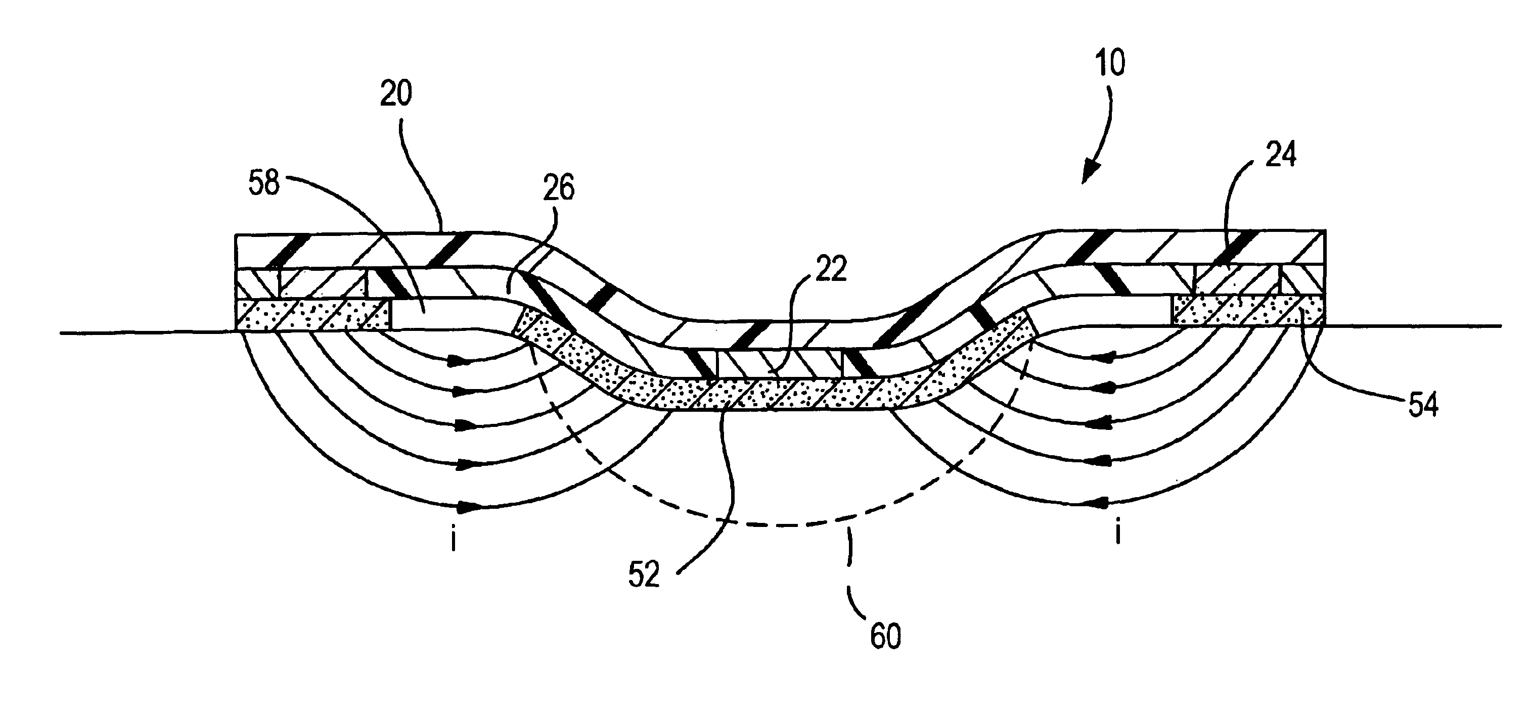 Apparatus and methods for facilitating wound healing