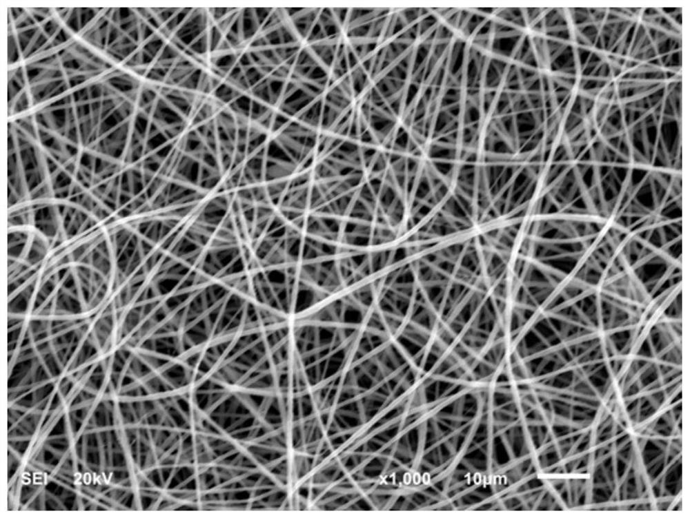 A polyethylene/carboxymethylete shell polyanose, nano -nano -fiber medical dressing and preparation methods and applications