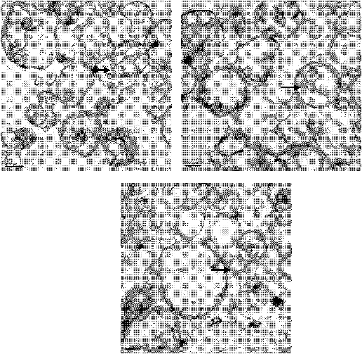 Application of H22 liver cancer cell autophagosome to preparation of liver cancer therapeutic vaccine